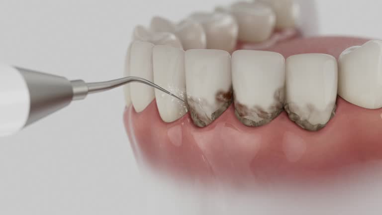 Trusted Teeth Cleaning And Checkup service in Lawson Heights, PA - Dentist Open Now
